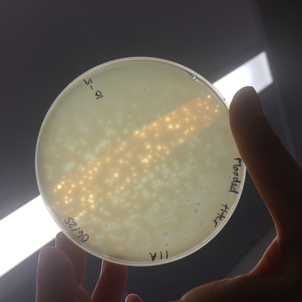 A Petri dish showing isolated phage plaques, visible structures formed within a cell culture. Each clear zone was formed because the bacteriophages killed the bacteria on a lawn of cells. 