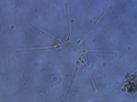 Asterionellopsis sp.