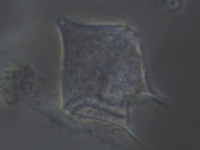 Protoperidinium sp.