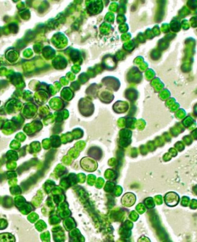 Toxic cyanobacteria