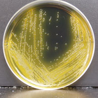 Vibrio vulnificus