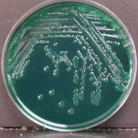 Vibrio parahaemolyticus